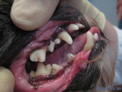 Чистка зубов ультразвуком. Фото после чистки